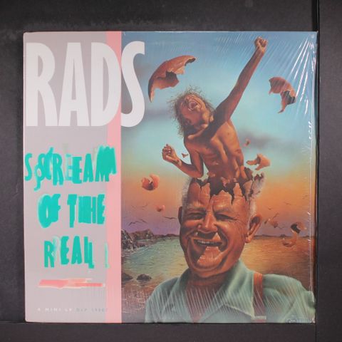 RADS
